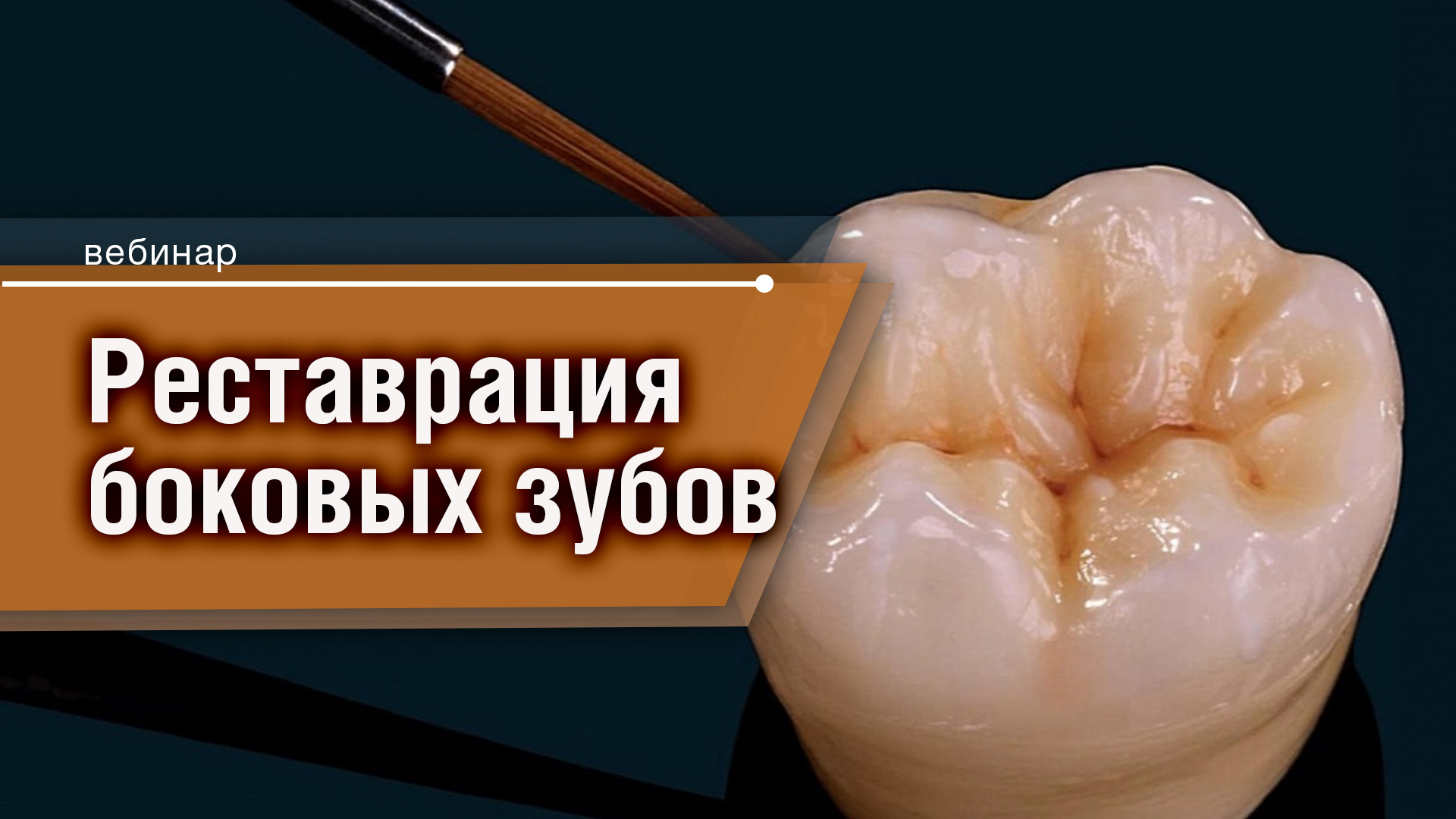 Реставрация боковых зубов