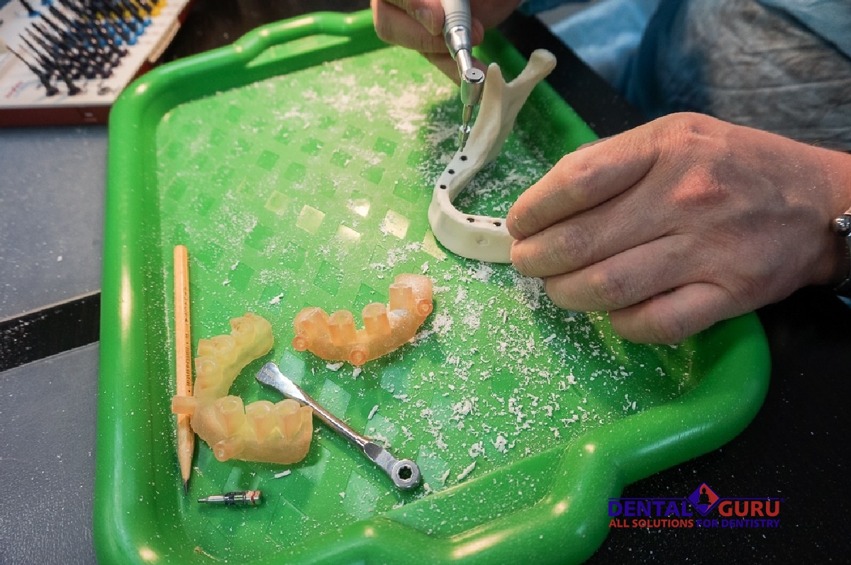 Экспертный курс по тотальной имплантации и протезированию при полном отсутствии зубов-Фото10.jpg