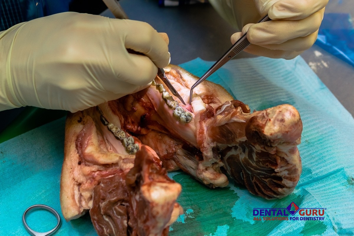 10-11 октября 2019. Панцулая В.Г. Пластика мягких тканей вокруг имплантатов. Морфологический подход-22.jpg