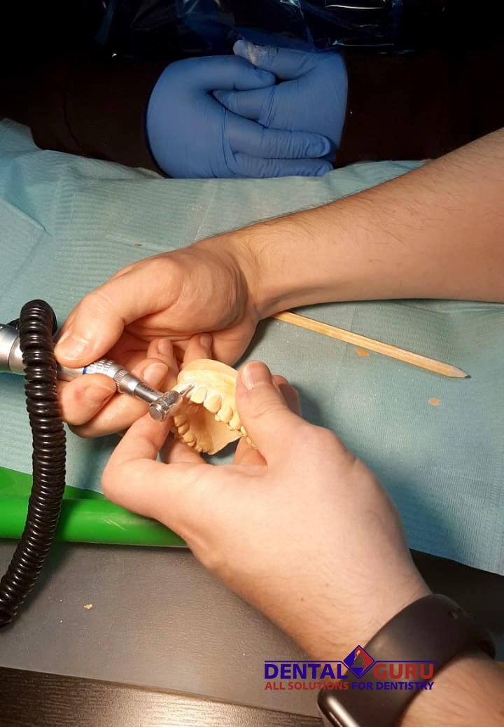 Препарирование зубов под цельнокерамические реставрации во фронтальном отделе. Пост-релиз 22 ноября-img21.jpg
