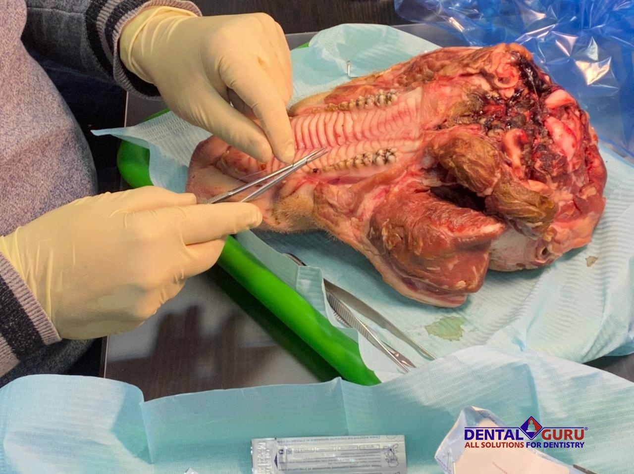 Дентальная имплантация с одновременной пластикой мягких тканей в сложных клинических случаях. 3 апреля 2021-WhatsApp Image 2021-04-05 at 11.38.37.jpeg